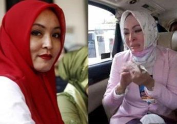Sekarang Wajahnya Glowing, Ini Cerita Angelina Sondakh yang Sempat Terkena Penyakit Kulit saat di Penjara
