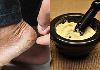 Kantong Jebol Kalau Perawatan, Cara Mengatasi Kaki dan Tumit Pecah-pecah Cuma Dioles Madu Campur Bawang Putih, Nyesel Gak Tahu dari Lama!