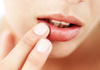 Jangan Dijilat, Ini 4 Cara Mengatasi Bibir Kering Saat Puasa