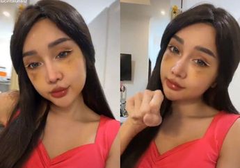 Pasca Oplas Makin Tambah Cantik, Lucinta Luna Ngaku Habis Uang Miliaran, Artis ini Langsung Tertarik: 'Puas Sama Hasilnya!'