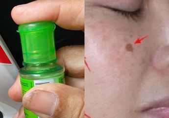 Bingung Wajah Mertua Kok Masih Mulus Tanpa Flek Hitam, Ternyata Modalnya Cuma Pakai Minyak Kayu Putih! Skincare Mahal Semua Lewat