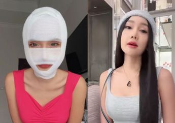Kini Mampu Jalani Operasi Plastik Senilai Rp 1 Miliar, Lucinta Luna Dulu Sempat Jadi Wanita Simpanan Para Sugar Daddy: Ada Syaratnya...
