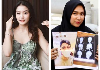 Kepalang Kecewa, Septia Siregar Kini Ngaku Ogah Ketemu Chandrika Chika Buntut Kasus Pengeroyokan Putra Siregar: Mengorbankan Orang Lain Dipenjara