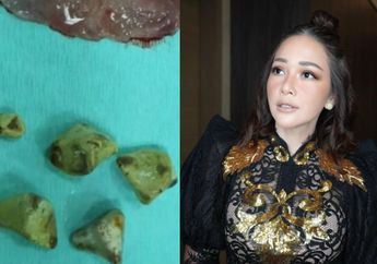 'Kalau Gak Kuat Lihat Diskip Aja', Maia Estianty Baru Selesai Jalani Operasi, Irwan Mussry Bergidik Ngeri Lihat Batu Empedu Besar di Perut Sang Istri