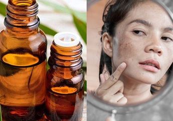 Jaminan Bikin Pangling Saat Lebaran! Cuma Modal Minyak Kayu Putih Bisa Bantu Usir Flek Hitam di Wajah, Ini Caranya