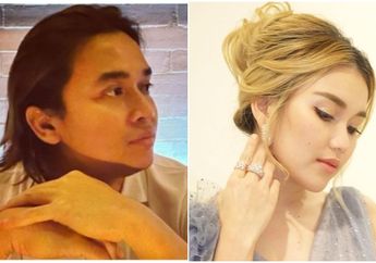 Ayu Ting Ting Pernah Ngemis Kerjaan Pada Mendiang Olga Syahputra, Billy Syahputra: Dulu Kampung Banget