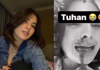 Astaga Ngeri, Geger Iqlima Kim Mantan Aspri Hotman Paris Diduga Kena Santet Sampai Diruqyah! Begini Tanda Seseorang Kena Santet atau Guna-guna dari Mudah Marah Hingga Linglung