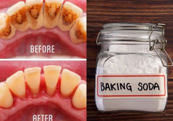 Capek-capek Disikat, Karang Gigi Ternyata Bisa Rontok Sendiri Cuma Modal Baking Soda, Jadi Irit Biaya ke Dokter