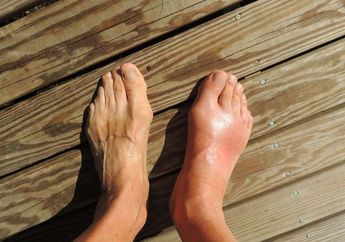 Mengalami 5 Tanda Ini di Kaki? Waspadai Ciri-ciri Terkena Diabetes