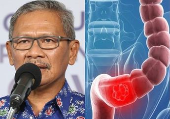 Para Istri Harus Tahu! Belajar dari Meninggalnya Achmad Yurianto Karena Kanker Usus, Sering Makan Daging Jenis Ini Ternyata Jadi Penyebab Utamanya