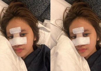 Niat Hati Ingin Mancungkan Hidung, Anak Artis Ini Justru Kena Apes, Kondisinya Setelah Operasi Plastik Justru Memprihatinkan hingga Impan yang Baru Dipasang Harus Dilepas