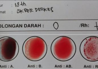 Asam Lambung Naik Mudah Dialami Pemilik Golongan Darah O, Hindari Terong