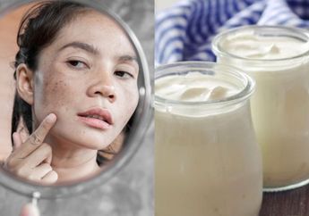 Cuma Butuh Waktu 20 Menit, Flek Hitam Membandel di Wajah Auto Lenyap Cuma Modal Minuman Murah di Warung Ini, Skincare Jadi Tak Terpakai deh!