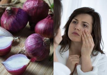 Gak Perlu Malu Lagi, Flek Hitam di Wajah Bisa Sirna Seketika Cuma Modal Bawang Merah dan Madu, Begini Cara Meraciknya