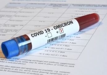 Omicron XBB Mendominasi 3 Minggu Terakhir Ini Gejala dan Cara Mengatasinya