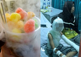 Seorang Bocah Alami Luka Bakar di Wajah Setelah Jajan Ice Smoke, Begini Penjelasan dari Pihak Kepolisian
