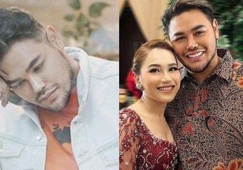 Jadi Bahan Ejekan Sahabat Dekat, Terungkap Biaya Permak Wajah Ivan Gunawan: Semua Urusan Turki