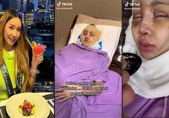 Sampai Tak Bisa Dikenali, Begini Wajah Baru Lucinta Luna Setelah Nekat Lakukan Beberapa Operasi Plastik Ekstrem, Netizen: Seperti Cewek Korea