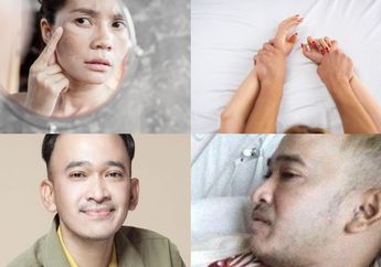 Berita Terpopuler: Cara Menghilangkan Flek Hitam di Pipi hingga Ruben Onsu Berangkat ke Singapura untuk Berobat