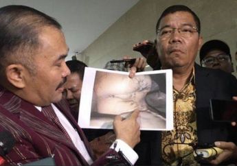 Bekas Luka-luka di Jenazah Masih Jadi Misteri, Sosok Ini Yakin Kalau Brigadir J Disiksa Psikopat sebelum Akhirnya Tewas: Kukunya Dicabut