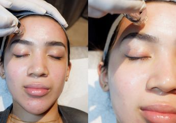 Cukup Sekali Perawatan Bisa Bikin Kulit Glowing, Ini Rahasianya