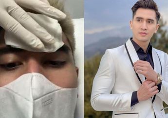 Innalillahi, Darah Mengucur Deras Di Wajah Verrel Bramasta, Ternyata Ini Penyebab Anak Venna Melinda Alami Kecelakaan Hingga Terima 20 Jahitan di Wajah