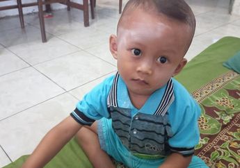 Penyebab Ruam Kulit pada Anak dan Cara Mengobatinya Secara Mudah