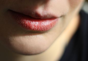 4 Tips Merawat Bibir Pecah-pecah Biar Kembali Sehat Merah Alami!