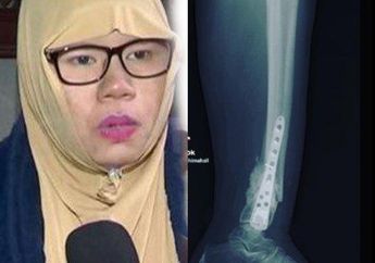 Dikira Bakal Hidup Bahagia Usai Lepas dari Bayang-Bayang Kiwil, Nyatanya Rohimah Kini Hidup Nelangsa, Terpaksa Sewakan Rumah demi Bayar Biaya Operasi