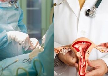 Hati-Hati! Operasi Miom Tidak Dianjurkan untuk Wanita dengan Kondisi Ini