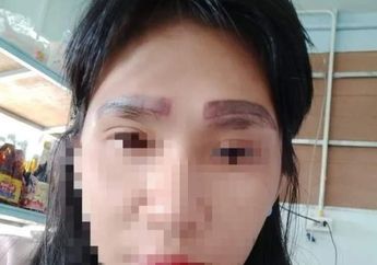Setelah Melakukan Prosedur Tato Alis di Sebuah Klinik Kecantikan, Wanita Ini Syok Bukan Main Saat Melihat Wajahnya Sendiri di Depan Cermin