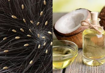 Bikin Malu Kalau Ketahuan, Kutu Rambut Bersih Sampai ke Telur-telurnya Bermodalkan Minyak Kelapa, Cukup Dipakai Seperti Ini