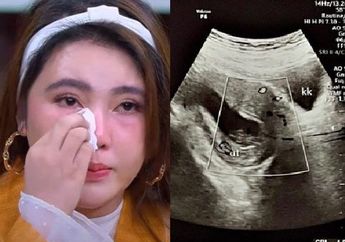 'Anakku Sudah di Surganya Allah' Duka Via Vallen Keguguran, Sempat Down Ungkap Kondisi Sang Calon Buah Hati! Para Bumil Hati-hati, Begini Ciri Janin Tidak Berkembang