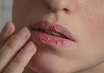 Tanpa Disadari Bisa Jadi Tanda Asam Lambung Tinggi, Ketahui Penyebab Bibir Kering dan Pecah-pecah, Waspadai Terinfeksi Covid-19