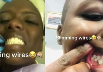 Bikin Geleng-geleng Kepala! Wanita Ini Menutup Mulutnya dengan 'Kabel Pelangsing' Agar Berat Badannya Turun
