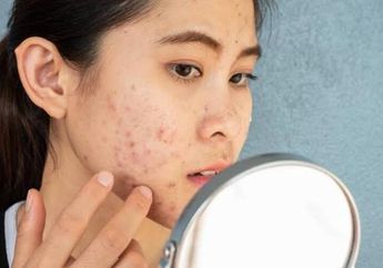 Skincare Bisa Gak Kepake, Noda Hitam Bekas Jerawat di Wajah Bisa Auto Hilang Cuma Modal Bumbu Opor Satu Ini, Contek Caranya Yuk!