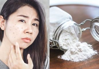 Ngapain Beli Skincare Terus, Padahal Bekas Jerawat Hitam Bisa Hilang dengan Baking Soda, Begini Cara Meraciknya Biar Ampuh
