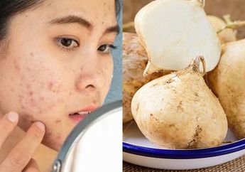 Skincare Bisa Gak Kepake, Noda Hitam Bekas Jerawat di Wajah Bisa Auto Hilang Cuma Modal Bengkoang, Contek Caranya Yuk!