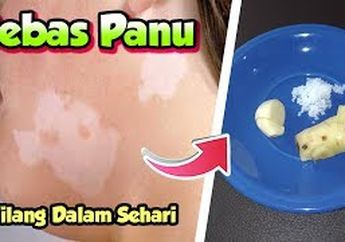 Bahan Alami Sederhana Bisa Menghilangkan Panu sampai ke Akar