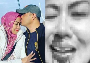 Hotman Paris Ungkap KDRT yang Dilakukan Ferry Irawan Lebih Dari Sekali, Venna Melinda Sempat Bongkar Tabiat Buruk Suami Soal Berhubungan Badan: Kayak Anak Kecil!