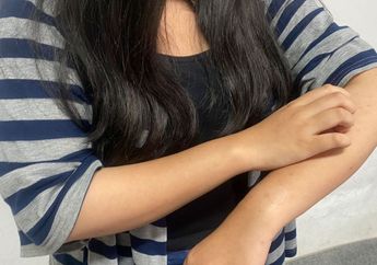 Cara Menghilangkan Lipoma Tanpa Operasi, Cukup dengan 3 Obat Alami Ini Langsung Manjur