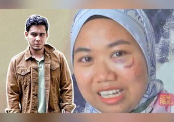 'Lebih Menyakitkan dari Melahirkan', Mengaku Ditinju Mantan Suami yang Berprofesi Aktor, Wanita Ini Dapat 10 Jahitan di Pipi