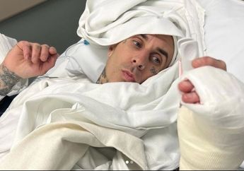 Batalin 2 Konser blink-182, Travis Barker Umbar Kondisi Usai Jalani Operasi Jari