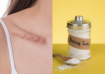 Bekas Luka Di Badan Bikin Kulit Jadi Burik, Padahal Luka yang Menghitam Bisa Pudar hingga Ke Dalam dengan Modal Baking Soda, Intip Caranya Yuk