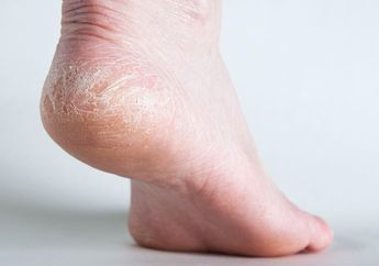 Cara Mengatasi Kaki pecah-pecah Agar Halus Lagi Tanpa Krim Kemasan, Pakai Bahan Ini Lebih Irit