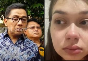 Kondisi Terbaru Rebecca Klopper Diungkap Kuasa Hukum, Sandy Arifin Sebut Kekasih Fadly Faisal Masih Drop Usai Terseret Kasus Video Syur