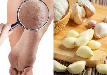 Bukan Pakai Krim Mahal, Rahasia Tumit Lembut dan Bebas Pecah-pecah Modalnya Cuma Pakai Bawang Putih, Ini Caranya