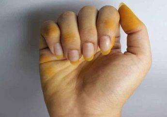 Cara Cepat Menghilangkan Noda Kunyit dari Kuku dan Tangan, Langsung Bersih Cuma Digosok-gosok Pakai Bahan Dapur Ini