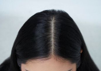 STOP Garuk-garuk Kepala, Begini Cara Cepat Hilangkan Ketombe Rambut Cuma Pakai 1 Bahan Dapur