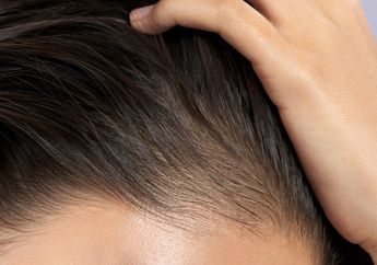 Cara Cepat Menumbuhkan Baby Hair di Jidat Agar Tidak Kelihatan Botak, Coba Oles Pakai 3 Bahan dari Dapur Ini